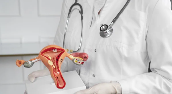 PCOS Management