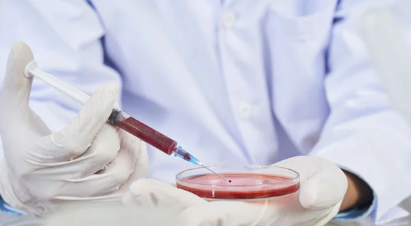 LBC (Liquid-Based Cytology) Test