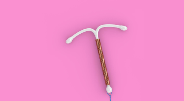 CuT (Copper-T) Insertion